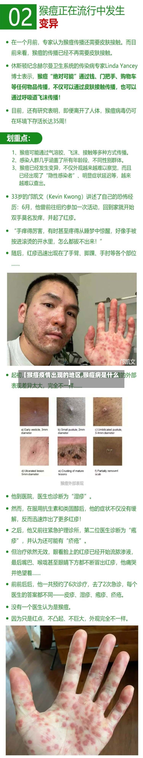 【猴痘疫情出现的地区,猴痘病是什么】